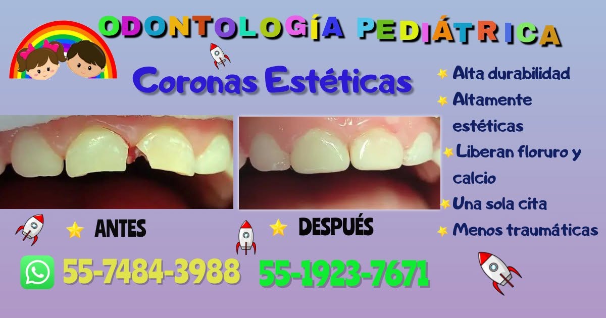 Limpieza 'Cero Ruido'